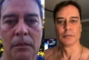 Veja antes e depois de Marcello Antony após harmonização: “Gostei bastante”