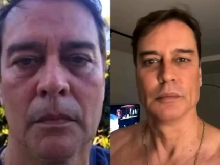 Veja antes e depois de Marcello Antony após harmonização: “Gostei bastante”