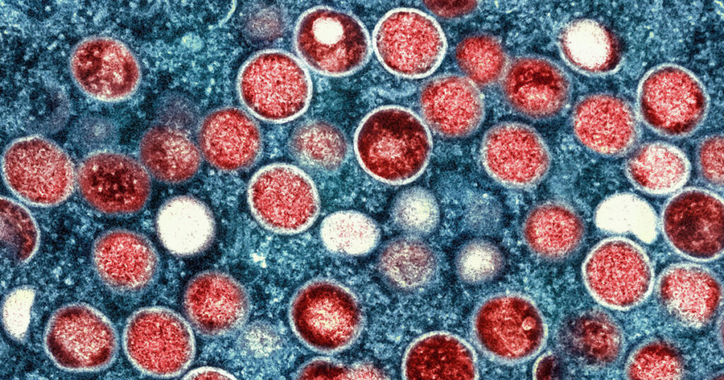 A OMS declara o MPOX uma emergência global de saúde pública pela segunda vez em dois anos